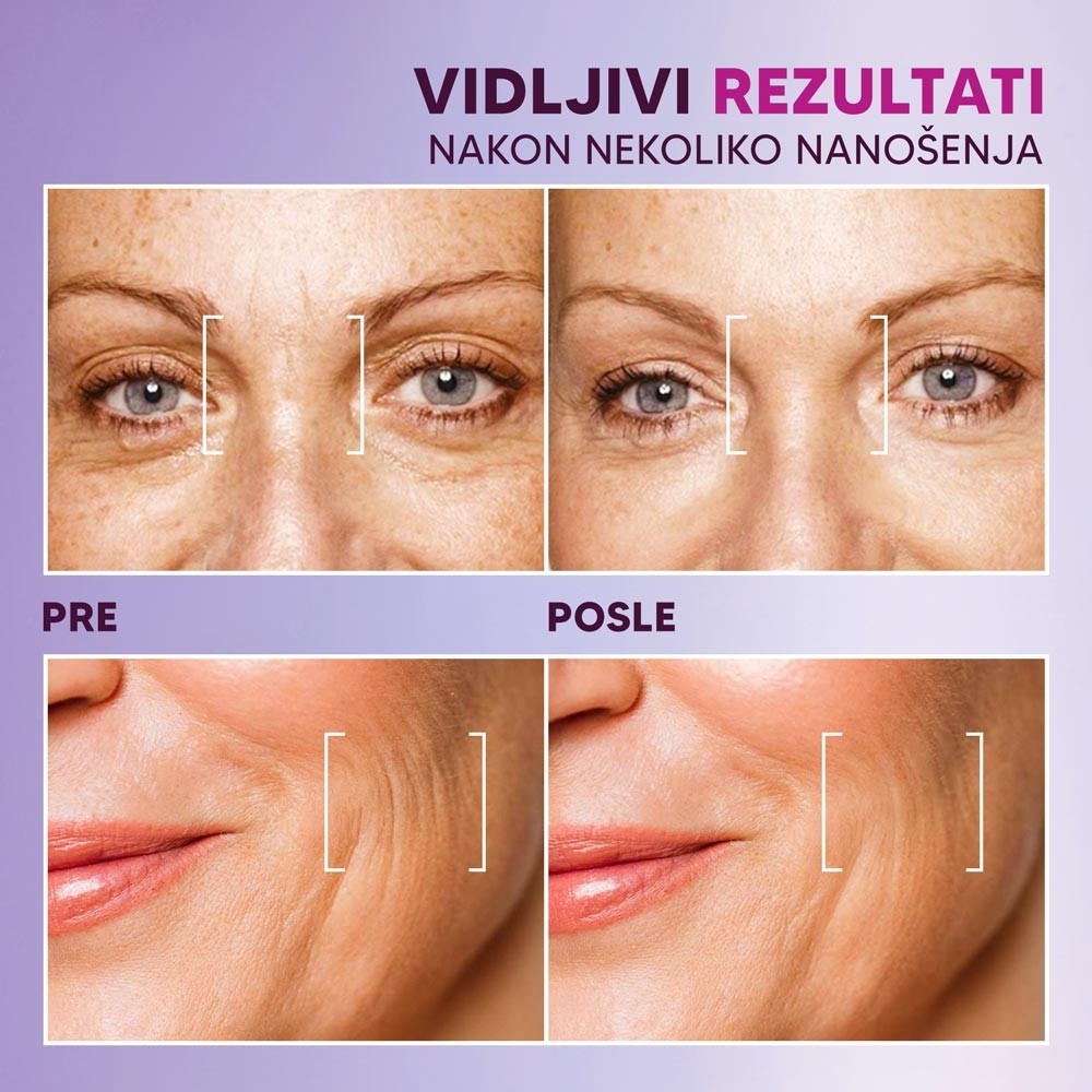 serum sa biopetidima pre posle srb